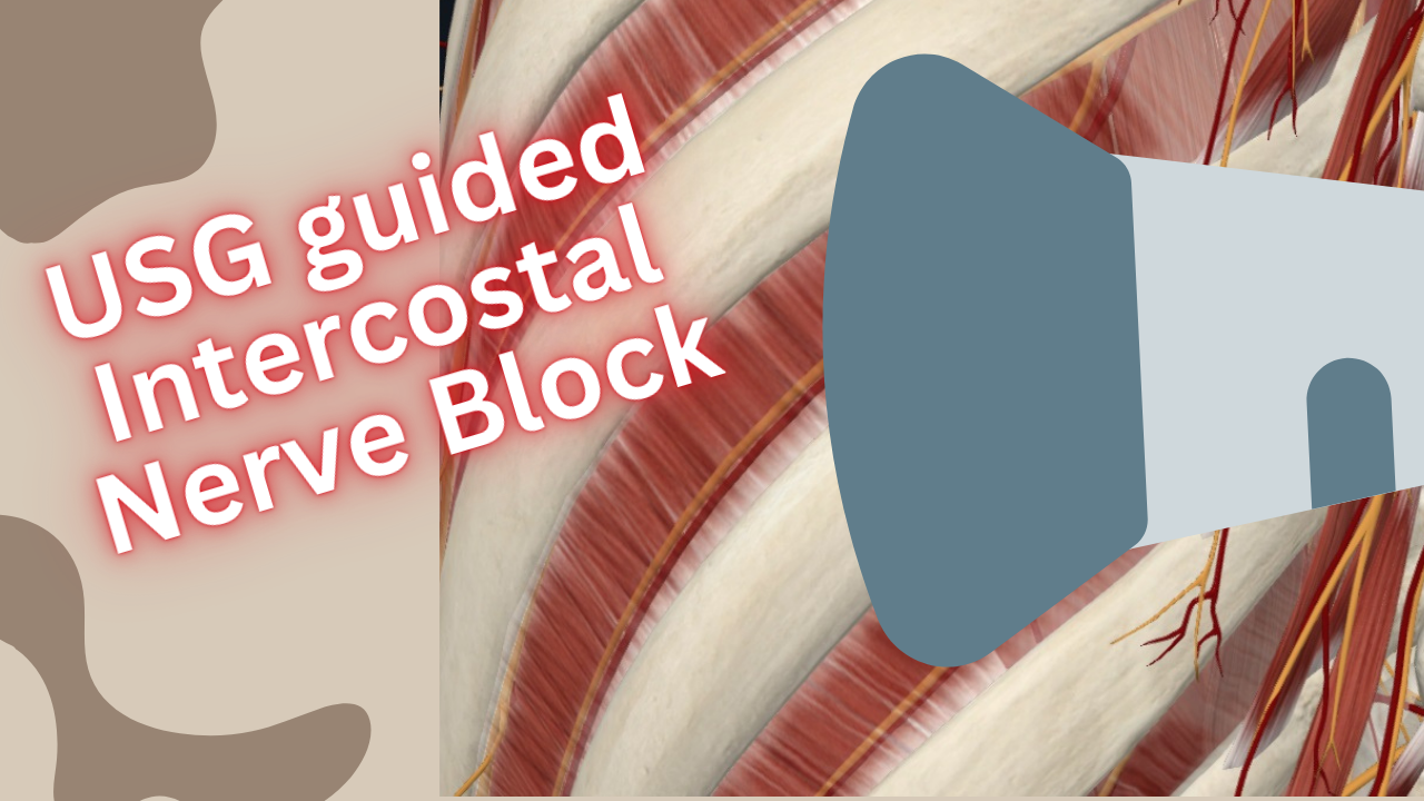 USG guided intercostal nerve block