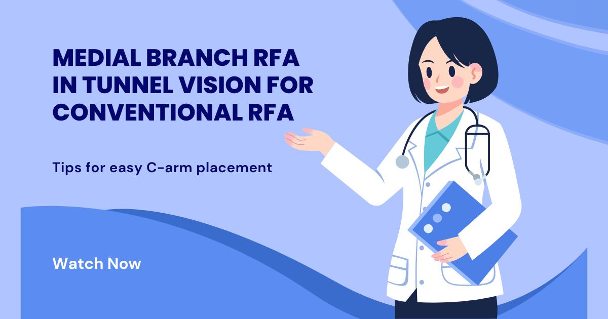 RFA facet